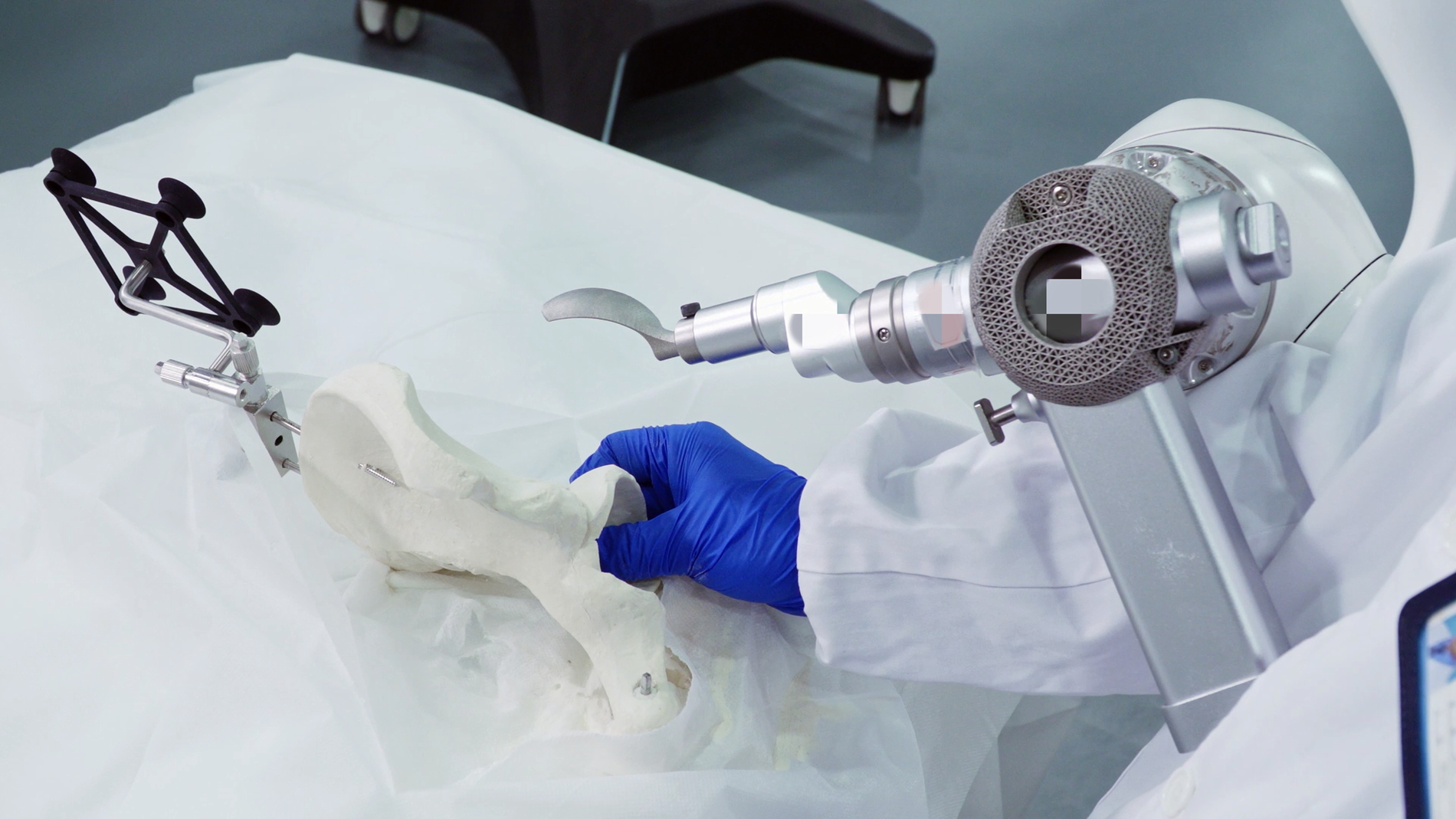 Rotatie-osteotomie van het acetabulum met een robotarm